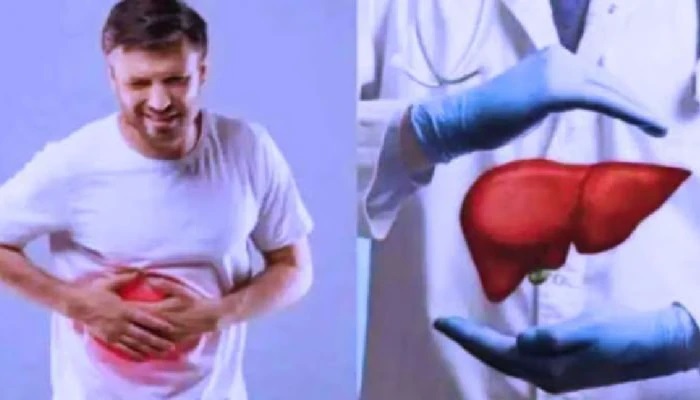 ఫ్యాటీ లివర్ అంటే ఏమిటి? కారణాలు, లక్షణాలు & చికిత్స