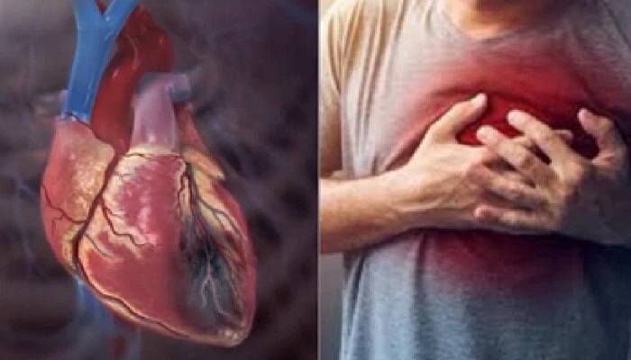 గుండెపోటు: ఈ ఒక్క పరీక్షతోనే గుండె జబ్బులను ముందుగానే గుర్తించవచ్చు.