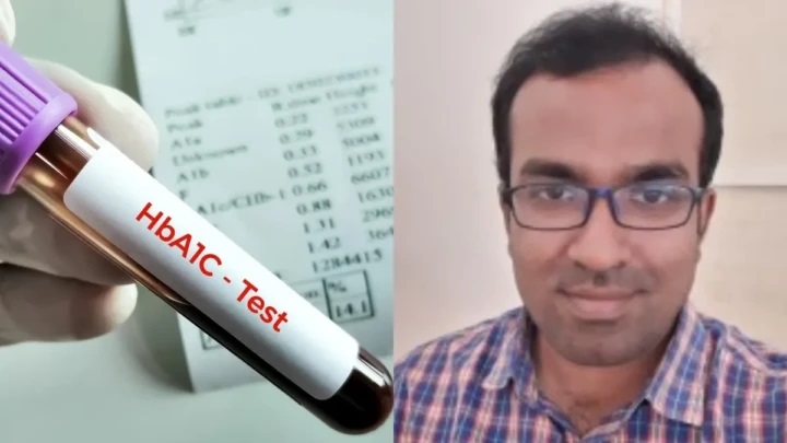 మధుమేహ నియంత్రణను తెలుసుకోవడానికి HbA1c పరీక్ష తప్పుడు ఫలితాలను ఇస్తుందా? వైద్యుల వివరణ!