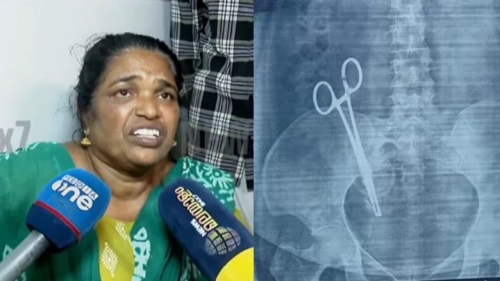 “మహిళ కడుపులో కత్తెర మర్చిపోయారు”; వండానం మెడికల్ కాలేజీపై ఫిర్యాదు