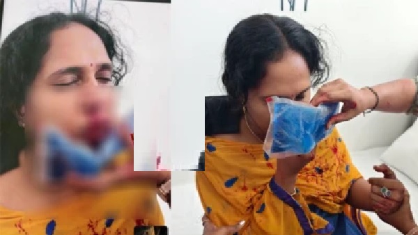 మాల్దీవుల్లో ఘోరం: మలయాళ ఉపాధ్యాయురాలిపై విద్యార్థి పైశాచిక దాడి.. క్లాస్‌లో గేమ్స్ వద్దన్నందుకు ముక్కు పచ్చడి చేసి రక్తం కళ్ళచూశాడు!
