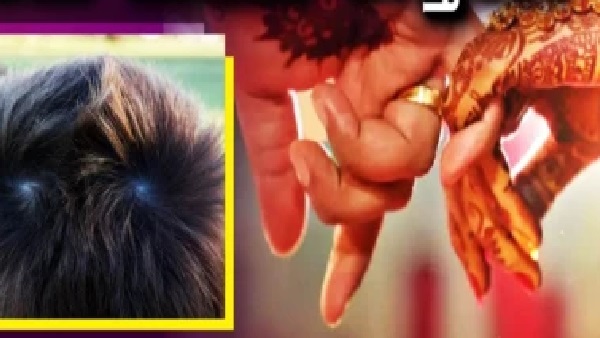 జుట్టు సుడి (Hair Whorls): తలపై 2 సుడులు ఉంటే 2 పెళ్లిళ్లు అవ్వడం గ్యారెంటీనా? మీ పిల్లలకు ఎన్ని సుడులు ఉన్నాయి?