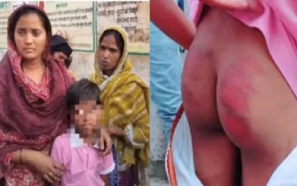 కేవలం 20 దెబ్బలే కదా!”.. 7 ఏళ్ల బాలుడి చేయి విరిచి, అంతరంగిక భాగాలపై దాడి చేసిన కర్కశ హెడ్ మాస్టర్!