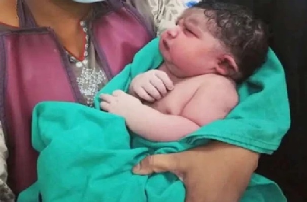 అస్సాంలో జన్మించిన 5.2 కేజీల శిశువు… వైద్యులు సైతం ఆశ్చర్యం!