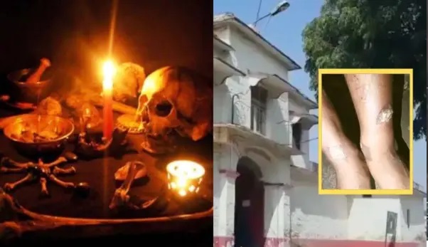 “నువ్వు ఒక మంత్రగత్తెవి”.. మాతాజీ ఆలయంలో బాలిక ఆక్రందనలు! ఎర్రగా కాల్చిన ఇనుప కడ్డీలతో దారుణ హింస!