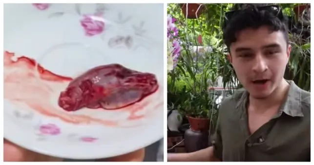 పాము గుండె కొట్టుకుంటోంది… బ్రతికున్న పాము గుండెను కోసి… అది కొట్టుకుంటుండగానే పూర్తిగా మింగేసిన యువకుడు! దిగ్భ్రాంతికి గురిచేసే వీడియో..!!!