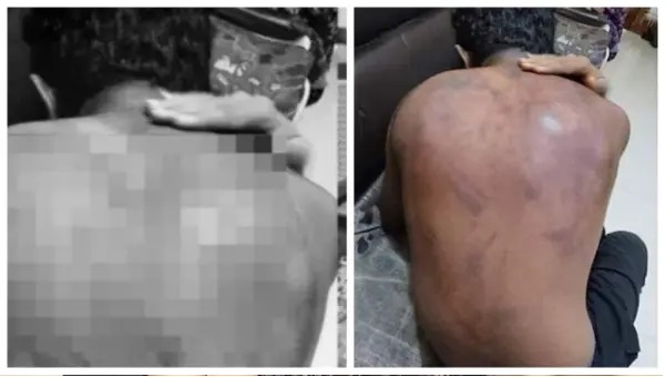 ఈ వయసులో ఏంట్రా ర్యాగింగ్..! “10వ తరగతి చదువుతున్నప్పుడే ఇంత కక్షా”..? మృగంలా కొట్టిన 15 ఏళ్ల బాలురు.. కప్పిపుచ్చిన పాఠశాల యాజమాన్యం. రోదిస్తున్న తల్లిదండ్రులు.!