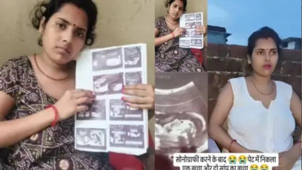 “నా గర్భాశయంలో పాము పిల్లలు పెరుగుతున్నాయి..” వైరల్ అవ్వడం కోసం ఇలా చేస్తారా.? వ్యూస్ (Views) కోసం ఒక మహిళ వ్యాప్తి చేసిన అబద్ధం. మండిపడుతున్న నెటిజన్లు.!!