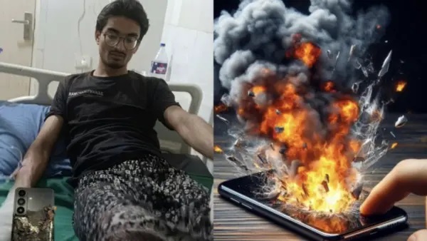 “గేమింగ్ పిచ్చితో వచ్చిన ముప్పు”: ప్యాంట్ జేబులో పేలిన స్మార్ట్‌ఫోన్.. ప్రైవేట్ పార్ట్స్, చేతులకు తీవ్ర గాయాలు.. విపరీతమైన వేడితో పేలిపోయిన వైనం.. షాకింగ్ ఘటన.!!