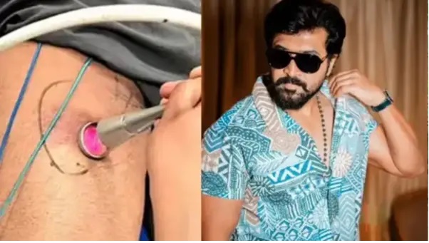 ‘అకస్మాత్తుగా చిరిగిన కండరం’.. ‘ఇరులన్’ షూటింగ్లో అరుణ్ విజయ్కు తీవ్ర గాయం; షాక్లో అభిమానులు..!