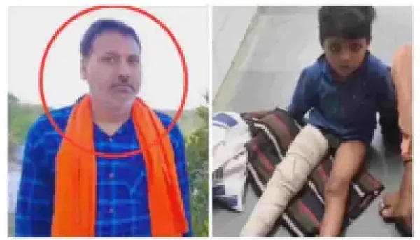 “బ్యాగు పోగొట్టుకున్నానని చెప్పడం ఒక నేరమా? అందుకని పసివాడి ఎముకను ఇలా విరగ్గొట్టావా!” – స్కూల్‌కు బ్యాగు తీసుకురాని 5 ఏళ్ల బాలుడిపై విచక్షణారహితంగా దాడి చేసిన కసాయి ఉపాధ్యాయుడు..!!!