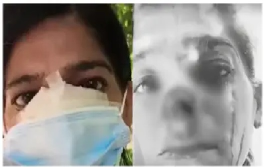“సామిని దర్శించుకోవడానికి వచ్చిన చోట రక్తమోడేలా అల్లాడిపోయేలా చేశారే!” – మహిళా భక్తురాలి ముక్కు కొరికి ముక్కుపుడక లాక్కెళ్లిన బిచ్చగాడు.. షాకింగ్ ఘటన..!!!