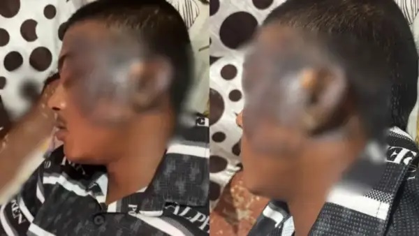 20 రూపాయలకు కేవలం 7 మోమోస్ మాత్రమేనా..? “చిన్న ప్రశ్నకు రగిలిపోయిన వ్యాపారి”.. విద్యార్థి ముఖంపై మరుగుతున్న నూనె పోత.. చెవులు, దవడలు కాలిపోయి అత్యంత కిరాతకం..!