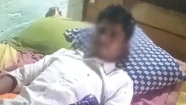కట్టలు తెంచుకున్న కోపం.. “మరిది మర్మాంగాన్ని పళ్లతో దారుణంగా కొరికిన వదిన”.. ప్రైవేట్ పార్ట్‌కు 55 కుట్లు.. ఐసీయూలో తీవ్ర చికిత్స.. చిన్న పిల్లల గొడవలో ఇంత ఘోరమా..?